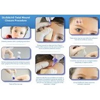 Glustitch 0.2ml Violet 12/bx