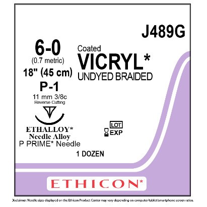 VICRYL 6/0 P-1 12/BX