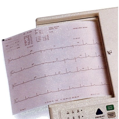ECG PAPER F/AT2 & AT2 PLUS 150SH/8PK/CS