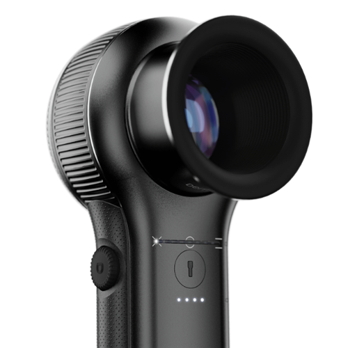 DermLite V DL5 Hybrid Dermatoscope