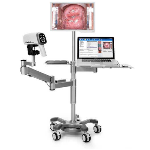 Edan C3A 24 LED Colposcope