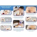 Glustitch 0.2ml Violet 12/bx