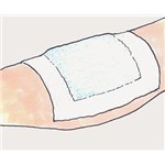 Mesorb 13cm x15cm 50/6BX/CS