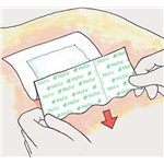 Mefix 10cm x 10m 1RL/20BX/CS