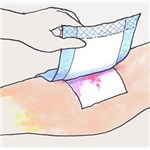 Mesorb 20cm x 30cm 30/4bx/cs