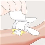 MESALT 10CM X 10CM  30/6BX/CS