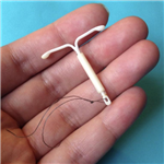 MIRENA IUD