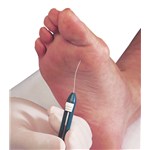 Neuropen Neuropathy Screening Device