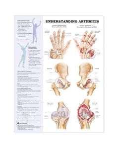 Anatomical Chart Understanding Arthritis